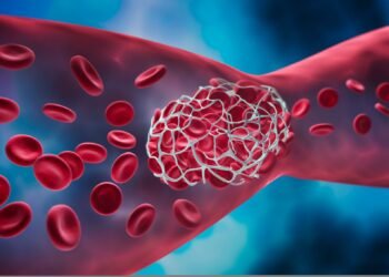 Fibrilația Atrială: O provocare în sănătatea cardiovasculară