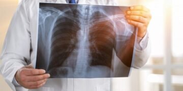 România, ţara cu cele mai multe îmbolnăviri de tuberculoză din Uniunea Europeană