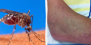 O boală tropicală periculoasă amenință aproape toată Europa