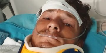 FOTO: Accident grav pentru Adrian Sovea, tânărul ieșean care alerga pentru copiii instituționalizați: „Astăzi am văzut moartea cu ochii mei”