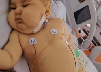 O fetiță de un an din Huși are nevoie de ajutor pentru a ajunge la un transplant de măduvă în Italia
